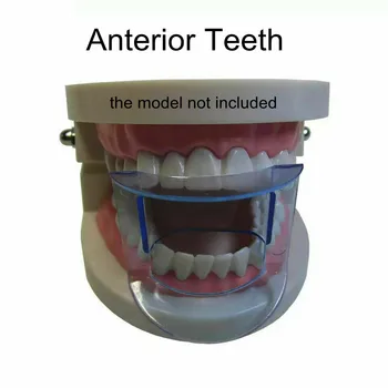 Zubné Úst Otvárač Ortodontická Pera, Líca Retractor Príslušenstvo Pre Predné Zuby